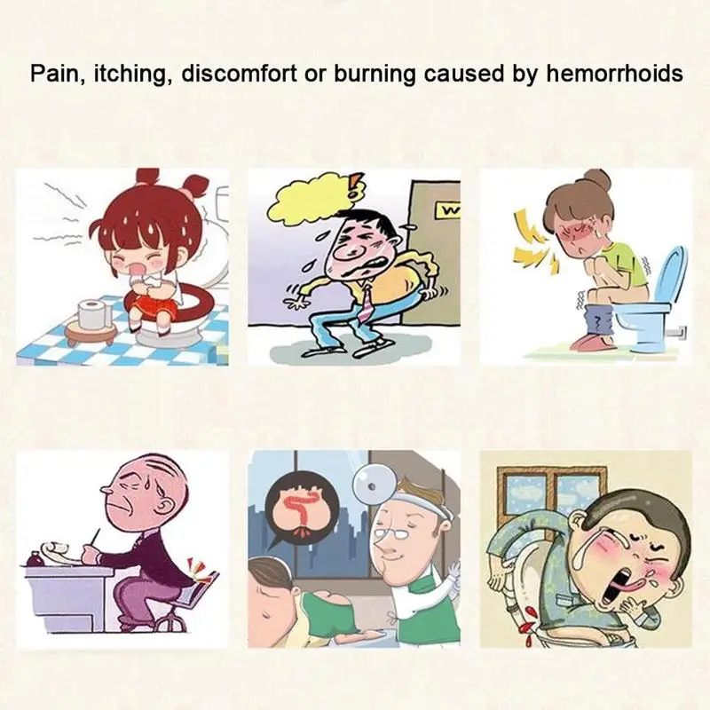 Melem za hemoroide Učinkovit tretman domaćih pilota, vanjski analni pukotina, akne, analni bol, kineska medicinska pomoć3