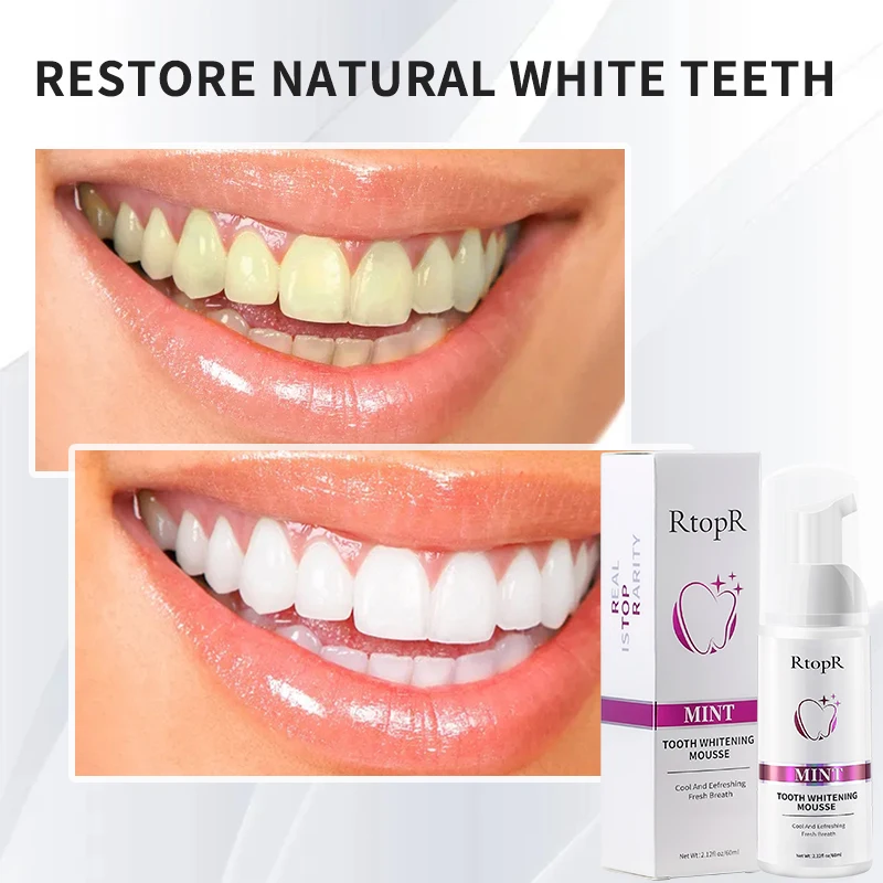 Odlicno pastu za čišćenje zuba, izbjeljivanje mousse, uklanja mrlje, plaketa, učinkovit отбеливающая serum, эссенция za njegu zuba, oralna higijena2